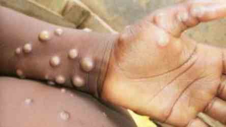 40 School Students Injured In Bee Attack In Agra...